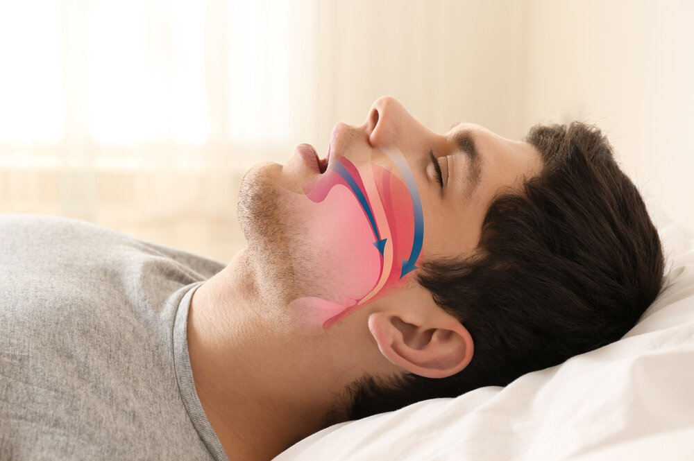 The Connection Between Sleep Apnea and Body Hormones